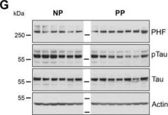 Anti-Actin Antibody, smooth muscle &#947; &amp; &#945; actin, clone CGA7 ascites fluid, clone CGA7, Chemicon&#174;