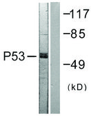Anti-p53, antibody produced in rabbit affinity isolated antibody