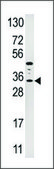 Anti-IGFBP3 (N-term) antibody produced in rabbit IgG fraction of antiserum, buffered aqueous solution
