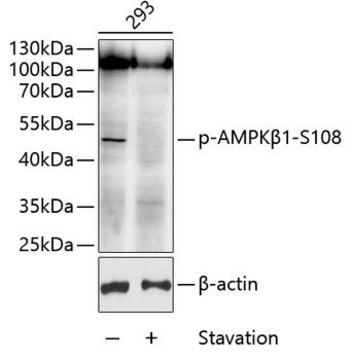 Anti-Phospho-AMPK&#946;1-S108 antibody produced in rabbit