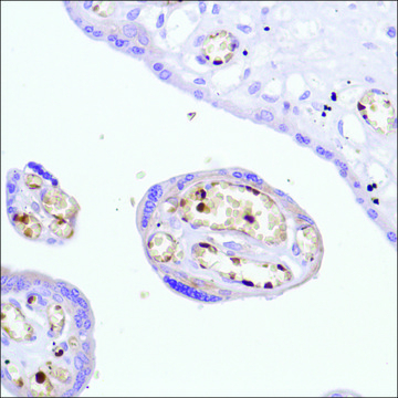 Anti-Haemoglobin Alpha Chain antibody, Rabbit monoclonal recombinant, expressed in proprietary host, clone SP212, affinity isolated antibody