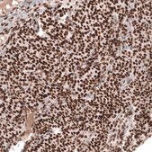 Monoclonal Anti-Msh2 Antibody Produced In Mouse Prestige Antibodies&#174; Powered by Atlas Antibodies, clone CL13764, affinity isolated antibody, buffered aqueous glycerol solution