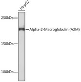 Anti-Alpha-2-Macroglobulin (A2M) Antibody, clone 7V6M10, Rabbit Monoclonal