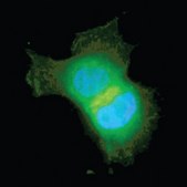 Anti-Akt/PKB Antibody, PH Domain, clone SKB1 clone SKB1, Upstate&#174;, from mouse