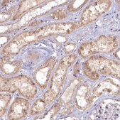 Anti-MICU2 antibody produced in rabbit Prestige Antibodies&#174; Powered by Atlas Antibodies, affinity isolated antibody, buffered aqueous glycerol solution