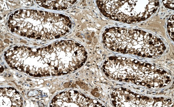 Anti-HSP90&#946; Antibody, clone 2E21 ZooMAb&#174; Rabbit Monoclonal recombinant, expressed in HEK 293 cells