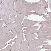 Anti-CHMP1B antibody produced in rabbit Prestige Antibodies&#174; Powered by Atlas Antibodies, affinity isolated antibody, buffered aqueous glycerol solution