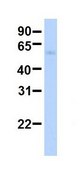 Anti-IRF6 antibody produced in rabbit affinity isolated antibody