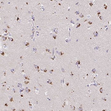 Anti-MAP1LC3A antibody produced in rabbit Prestige Antibodies&#174; Powered by Atlas Antibodies, affinity isolated antibody, buffered aqueous glycerol solution