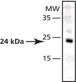 Anti-Superoxide Dismutase (MnSOD) (DD-17) antibody produced in rabbit affinity isolated antibody, buffered aqueous solution