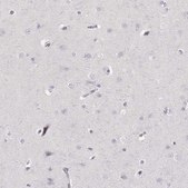 Anti-ELANE antibody produced in rabbit Prestige Antibodies&#174; Powered by Atlas Antibodies, affinity isolated antibody