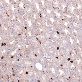 Anti-SLC18A2 antibody produced in mouse Prestige Antibodies&#174; Powered by Atlas Antibodies, clone CL13157, purified by using Protein A, buffered aqueous glycerol solution