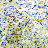 Anti-phospho-PLD2 (pTyr169) antibody produced in rabbit affinity isolated antibody