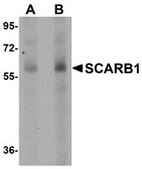Anti-SCARB1 antibody produced in rabbit affinity isolated antibody