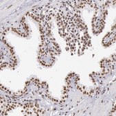 Anti-HNRNPH2 antibody produced in rabbit Ab1, Prestige Antibodies&#174; Powered by Atlas Antibodies, affinity isolated antibody, buffered aqueous glycerol solution