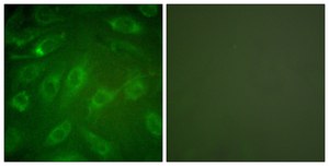 Anti-Collagen I antibody produced in rabbit affinity isolated antibody