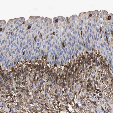 Anti-LIF antibody produced in rabbit Prestige Antibodies&#174; Powered by Atlas Antibodies, affinity isolated antibody, buffered aqueous glycerol solution