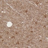 Anti-RDX antibody produced in rabbit Ab1, Prestige Antibodies&#174; Powered by Atlas Antibodies, affinity isolated antibody, buffered aqueous glycerol solution