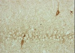 Anti-Glutamate Decarboxylase Antibody, 65 kDa isoform, clone GAD-6 clone GAD-6, Chemicon&#174;, from mouse