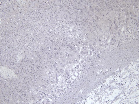 Anti-VMAT2/SLC18A2 antibody produced in goat affinity isolated antibody, buffered aqueous solution