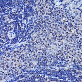 Anti-Phospho-JNK1/2/3-T183/T183/T221 antibody produced in rabbit