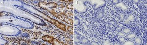 Anti-Estrogen Receptor &#945; Antibody from rabbit, purified by affinity chromatography