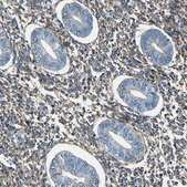 Anti-COL3A1 antibody produced in rabbit Prestige Antibodies® Powered by Atlas Antibodies, affinity isolated antibody, buffered aqueous glycerol solution