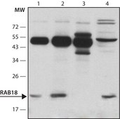 Anti-Rab18 antibody produced in rabbit ~1.0&#160;mg/mL, affinity isolated antibody