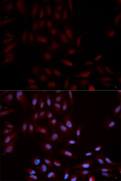 Anti-Phospho-p38 MAPK-Y322 antibody produced in rabbit