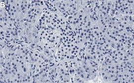 Anti-ACLY Antibody, clone 1B16 ZooMAb&#174; Rabbit Monoclonal recombinant, expressed in HEK 293 cells