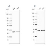 Anti-CA3 antibody produced in rabbit Prestige Antibodies&#174; Powered by Atlas Antibodies, affinity isolated antibody, buffered aqueous glycerol solution, Ab1
