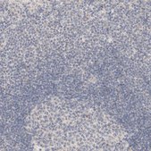 Anti-CA13 antibody produced in rabbit Prestige Antibodies® Powered by Atlas Antibodies, affinity isolated antibody, buffered aqueous glycerol solution