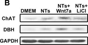 Anti-Choline Acetyltransferase Antibody, clone 1E6 ascites fluid, clone 1E6, Chemicon&#174;