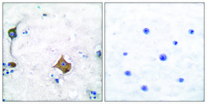 Anti-Synaptophysin antibody produced in rabbit affinity isolated antibody