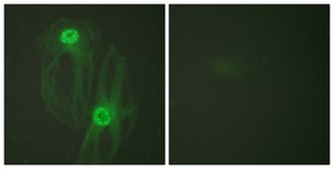 Anti-KIF11 antibody produced in rabbit affinity isolated antibody