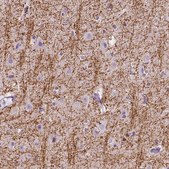 Anti-SIRT2 antibody produced in rabbit Prestige Antibodies® Powered by Atlas Antibodies, affinity isolated antibody, buffered aqueous glycerol solution