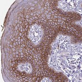 Anti-DSC3 antibody produced in rabbit Prestige Antibodies&#174; Powered by Atlas Antibodies, affinity isolated antibody, buffered aqueous glycerol solution