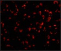 Anti-DEDAF antibody produced in rabbit affinity isolated antibody, buffered aqueous solution