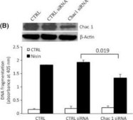 Anti-CHAC1 antibody produced in rabbit affinity isolated antibody