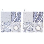 Anti-RSPH1 antibody produced in rabbit Prestige Antibodies&#174; Powered by Atlas Antibodies, affinity isolated antibody, buffered aqueous glycerol solution
