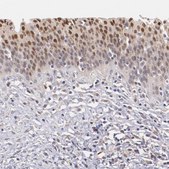 Anti-ATF3 antibody produced in rabbit Prestige Antibodies&#174; Powered by Atlas Antibodies, affinity isolated antibody, buffered aqueous glycerol solution