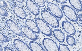 Anti-RAD21 Antibody, clone 2H12 ZooMAb&#174; Rabbit Monoclonal recombinant, expressed in HEK 293 cells