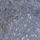 Anti-BVES antibody produced in rabbit Prestige Antibodies&#174; Powered by Atlas Antibodies, affinity isolated antibody, buffered aqueous glycerol solution