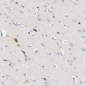 Anti-LDLR antibody produced in rabbit Ab1, affinity isolated antibody, buffered aqueous glycerol solution