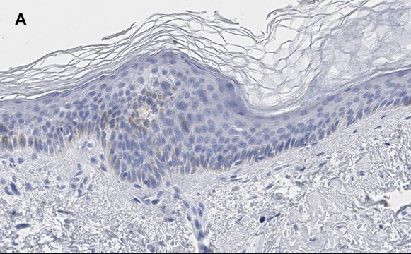 Anti-phos-AMPK&#945; (Thr172) Antibody, clone 5J23 , ZooMAb&#174; Rabbit Monoclonal recombinant, expressed in HEK 293 cells