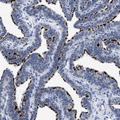 Anti-RINT1 antibody produced in rabbit Prestige Antibodies&#174; Powered by Atlas Antibodies, affinity isolated antibody, buffered aqueous glycerol solution