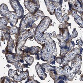 Anti-NEU1 antibody produced in rabbit Prestige Antibodies&#174; Powered by Atlas Antibodies, affinity isolated antibody, buffered aqueous glycerol solution