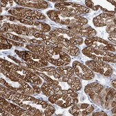 Anti-KRT8 antibody produced in rabbit Prestige Antibodies&#174; Powered by Atlas Antibodies, affinity isolated antibody, buffered aqueous glycerol solution