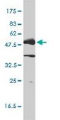 Monoclonal Anti-LCK antibody produced in mouse clone 3F7-F5, purified immunoglobulin, buffered aqueous solution