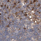 Anti-ASCC3 antibody produced in rabbit Prestige Antibodies® Powered by Atlas Antibodies, affinity isolated antibody, buffered aqueous glycerol solution, ab1